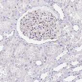 Anti-PSMB9 antibody produced in rabbit Prestige Antibodies® Powered by Atlas Antibodies, affinity isolated antibody, buffered aqueous glycerol solution