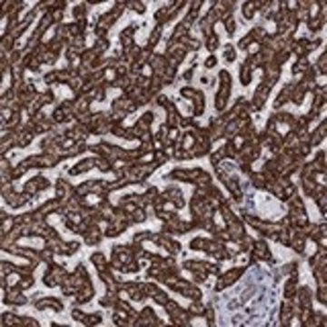 Anti-ALDH1B1 antibody produced in rabbit Prestige Antibodies&#174; Powered by Atlas Antibodies, affinity isolated antibody, buffered aqueous glycerol solution