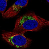 Anti-HADHB antibody produced in rabbit Prestige Antibodies® Powered by Atlas Antibodies, affinity isolated antibody