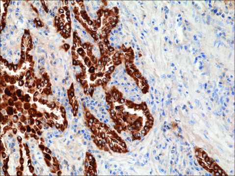 Anti-SP-B (Surfactant protein B) antibody, Rabbit monoclonal recombinant, expressed in HEK 293 cells, clone RM370, purified immunoglobulin