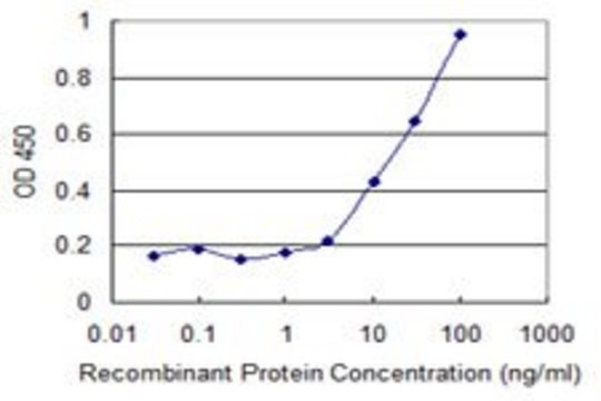 Monoclonal Anti-CPT2 antibody produced in mouse clone 1E10, purified immunoglobulin, buffered aqueous solution