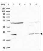Anti-MRPL17 antibody produced in rabbit Prestige Antibodies® Powered by Atlas Antibodies, affinity isolated antibody, buffered aqueous glycerol solution