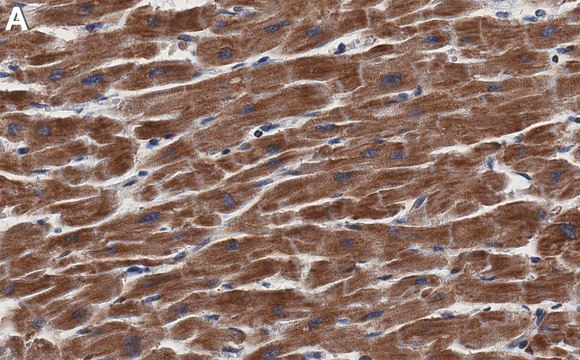 Anti-AGK Antibody, clone 1F21 ZooMAb&#174; Rabbit Monoclonal recombinant, expressed in HEK 293 cells