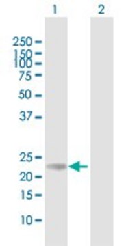 Anti-RS1 antibody produced in mouse purified immunoglobulin, buffered aqueous solution