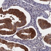 Anti-BLVRA antibody produced in rabbit Prestige Antibodies® Powered by Atlas Antibodies, affinity isolated antibody, buffered aqueous glycerol solution