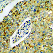 Anti-phospho-CK-1 α (pTyr294) antibody produced in rabbit affinity isolated antibody