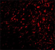 Anti-TEM5 antibody produced in rabbit affinity isolated antibody