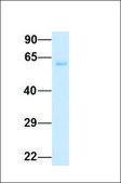 Anti-SLC7A7 antibody produced in rabbit affinity isolated antibody