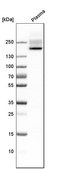 Anti-CFH antibody produced in rabbit Prestige Antibodies® Powered by Atlas Antibodies, affinity isolated antibody, buffered aqueous glycerol solution