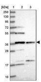 Anti-FAM118B antibody produced in rabbit Prestige Antibodies® Powered by Atlas Antibodies, affinity isolated antibody, buffered aqueous glycerol solution