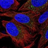 Anti-PIK3R4 antibody produced in rabbit Prestige Antibodies® Powered by Atlas Antibodies, affinity isolated antibody, buffered aqueous glycerol solution