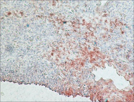 Monoclonal Anti-Rabbit Immunoglobulins–Peroxidase antibody produced in mouse clone RG-16, purified immunoglobulin, lyophilized powder