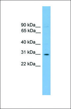 Anti-ELF5 antibody produced in rabbit affinity isolated antibody