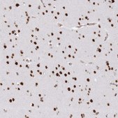 Anti-ZNF638 antibody produced in rabbit Prestige Antibodies® Powered by Atlas Antibodies, affinity isolated antibody, buffered aqueous glycerol solution