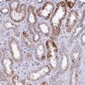 Anti-TMEM178B antibody produced in rabbit Prestige Antibodies® Powered by Atlas Antibodies, affinity isolated antibody, buffered aqueous glycerol solution