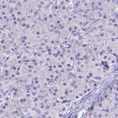 Monoclonal Anti-SLC27A5 antibody produced in mouse Prestige Antibodies® Powered by Atlas Antibodies, clone CL0213, purified immunoglobulin, buffered aqueous glycerol solution