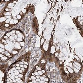 Anti-PNPT1 antibody produced in rabbit Prestige Antibodies® Powered by Atlas Antibodies, affinity isolated antibody, buffered aqueous glycerol solution