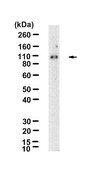 Anti-Catenin α-1 Antibody, clone 1D15 ZooMAb® Rabbit Monoclonal recombinant, expressed in HEK 293 cells