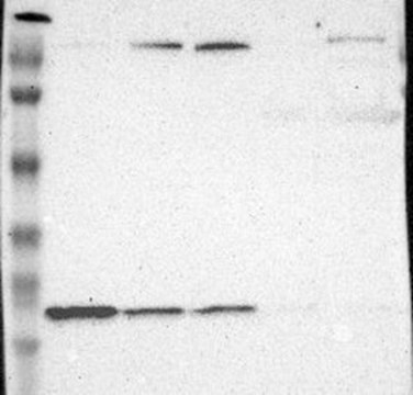 Anti-WDHD1 antibody produced in rabbit Prestige Antibodies&#174; Powered by Atlas Antibodies, affinity isolated antibody, buffered aqueous glycerol solution