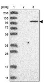 Anti-PARP10 antibody produced in rabbit Prestige Antibodies® Powered by Atlas Antibodies, affinity isolated antibody, buffered aqueous glycerol solution