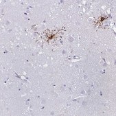 Anti-GPR17 antibody produced in rabbit Prestige Antibodies® Powered by Atlas Antibodies, affinity isolated antibody, buffered aqueous glycerol solution