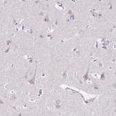 Anti-MRPL36 antibody produced in rabbit Prestige Antibodies® Powered by Atlas Antibodies, affinity isolated antibody, buffered aqueous glycerol solution