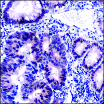 Anti-MSH2 antibody, Rabbit monoclonal clone SP46, recombinant, expressed in proprietary host, affinity isolated antibody