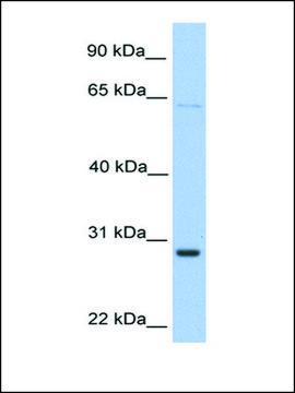 Anti-HPRT1 antibody produced in rabbit affinity isolated antibody