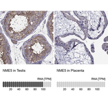 Anti-NME5 antibody produced in rabbit Prestige Antibodies&#174; Powered by Atlas Antibodies, affinity isolated antibody, buffered aqueous glycerol solution