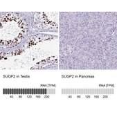 Anti-SUGP2 antibody produced in rabbit Prestige Antibodies® Powered by Atlas Antibodies, affinity isolated antibody, buffered aqueous glycerol solution