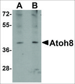 Anti-ATOH8 antibody produced in rabbit affinity isolated antibody, buffered aqueous solution