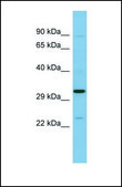 Anti-SET, (N-terminal) antibody produced in rabbit affinity isolated antibody