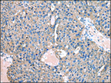 Anti-CASK affinity isolated antibody