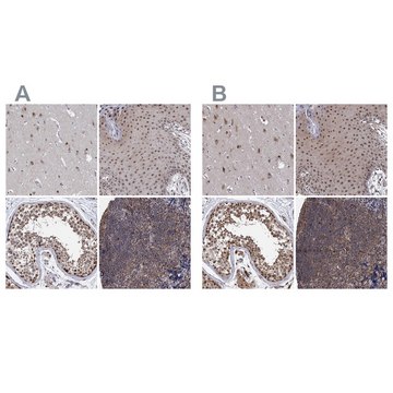 Anti-PSMD4 antibody produced in rabbit Prestige Antibodies&#174; Powered by Atlas Antibodies, affinity isolated antibody, buffered aqueous glycerol solution