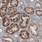 Monoclonal Anti-ACAA1 antibody produced in mouse Prestige Antibodies® Powered by Atlas Antibodies, clone CL2663, purified immunoglobulin, buffered aqueous glycerol solution