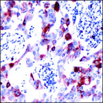 Anti-S6 Ribosomal Protein (phospho S240/244) antibody, Rabbit monoclonal clone SP45, recombinant, expressed in proprietary host, affinity isolated antibody