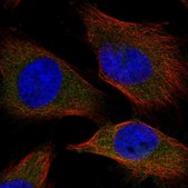 Anti-SPC25 antibody produced in rabbit Prestige Antibodies® Powered by Atlas Antibodies, affinity isolated antibody, buffered aqueous glycerol solution