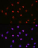 Anti- Acetyl-HMGB1-K29 antibody produced in rabbit