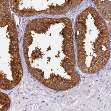 Anti-WDR92 antibody produced in rabbit Prestige Antibodies&#174; Powered by Atlas Antibodies, affinity isolated antibody, buffered aqueous glycerol solution