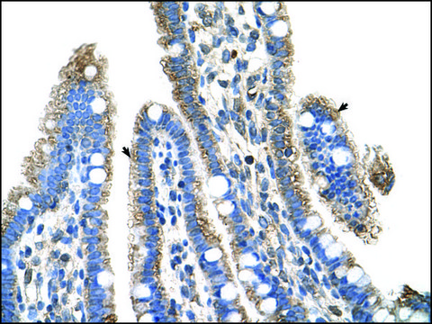 Anti-SLC25A39 antibody produced in rabbit affinity isolated antibody