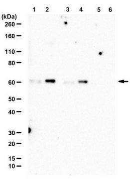 Anti-phospho-SIN1 (Thr86) from rabbit, purified by affinity chromatography