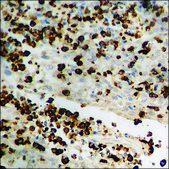 Anti-phospho-p62 Dok (pTyr398) antibody produced in rabbit affinity isolated antibody