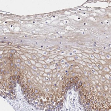 Anti-ADRA2C antibody produced in rabbit Prestige Antibodies&#174; Powered by Atlas Antibodies, affinity isolated antibody, buffered aqueous glycerol solution