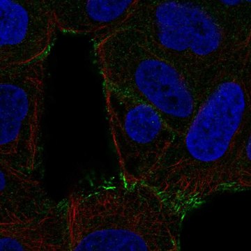 Anti-Sptlc2 Antibody Produced In Rabbit Prestige Antibodies&#174; Powered by Atlas Antibodies, affinity isolated antibody, buffered aqueous glycerol solution