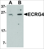 Anti-C2orf40 antibody produced in rabbit affinity isolated antibody