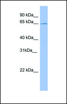 Anti-METTL3 antibody produced in rabbit affinity isolated antibody