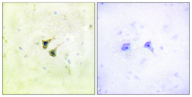 Anti-PBK antibody produced in rabbit affinity isolated antibody