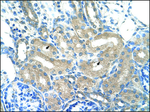 Anti-ADH1B antibody produced in rabbit IgG fraction of antiserum