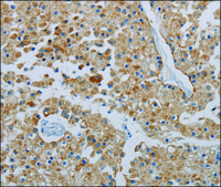 Anti-PPARGC1B antibody produced in rabbit affinity isolated antibody