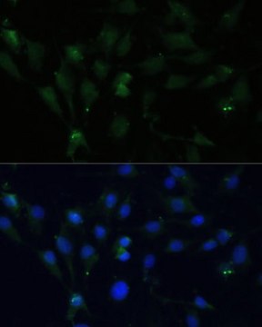 Anti-ZWINT antibody produced in rabbit